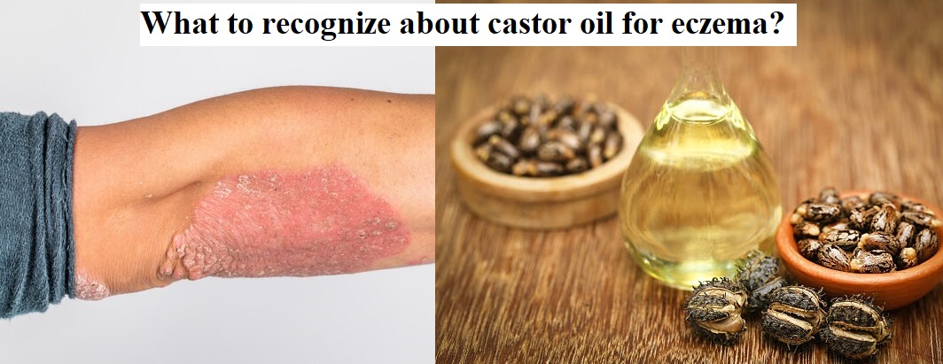 What to recognize about castor oil for eczema?